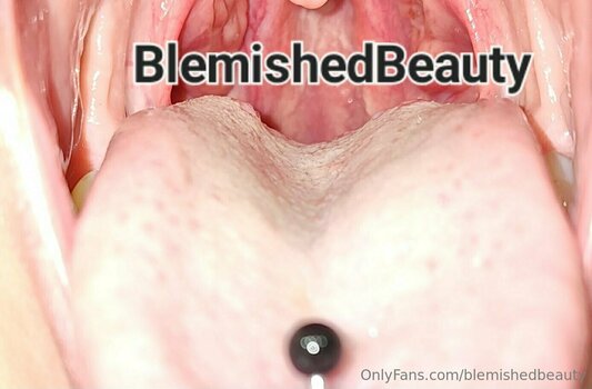 blemishedbeauty Nude Leaks Photo 22
