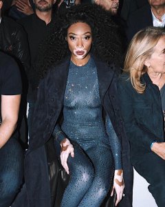 Winnie Harlow See Through Pics 3 thefappeningblog.com.jpg