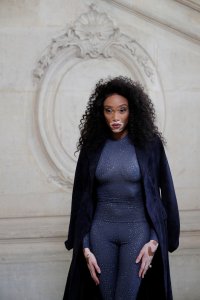 Winnie Harlow See Through 16 thefappeningblog.com.jpg