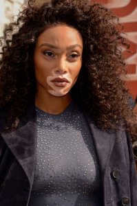 Winnie Harlow See Through 43 thefappeningblog.com.jpg