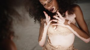 Winnie Harlow 26 thefappeningblog.com.JPG