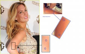 Bar-Refaeli-Photo-Proofs-Freckles on the arm.jpg