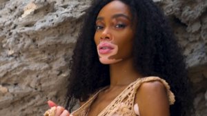 Winnie Harlow Sexy TheFappeningBlog.com 3.jpg