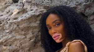 Winnie Harlow Sexy TheFappeningBlog.com 2.jpg