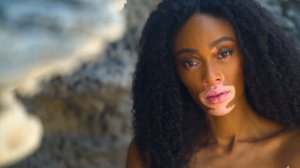 Winnie Harlow Sexy TheFappeningBlog.com 11.jpg