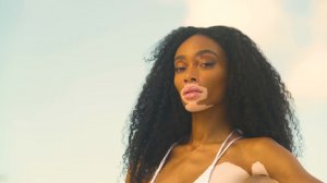 Winnie Harlow Sexy TheFappeningBlog.com 13.jpg