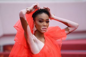 Winnie Harlow Sexy TheFappeningBlog.com 1.jpg