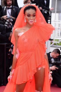 Winnie Harlow Sexy Cannes TheFappeningBlog.com 19.jpg