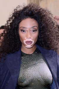 Winnie Harlow See Through 17 thefappeningblog.com.jpg