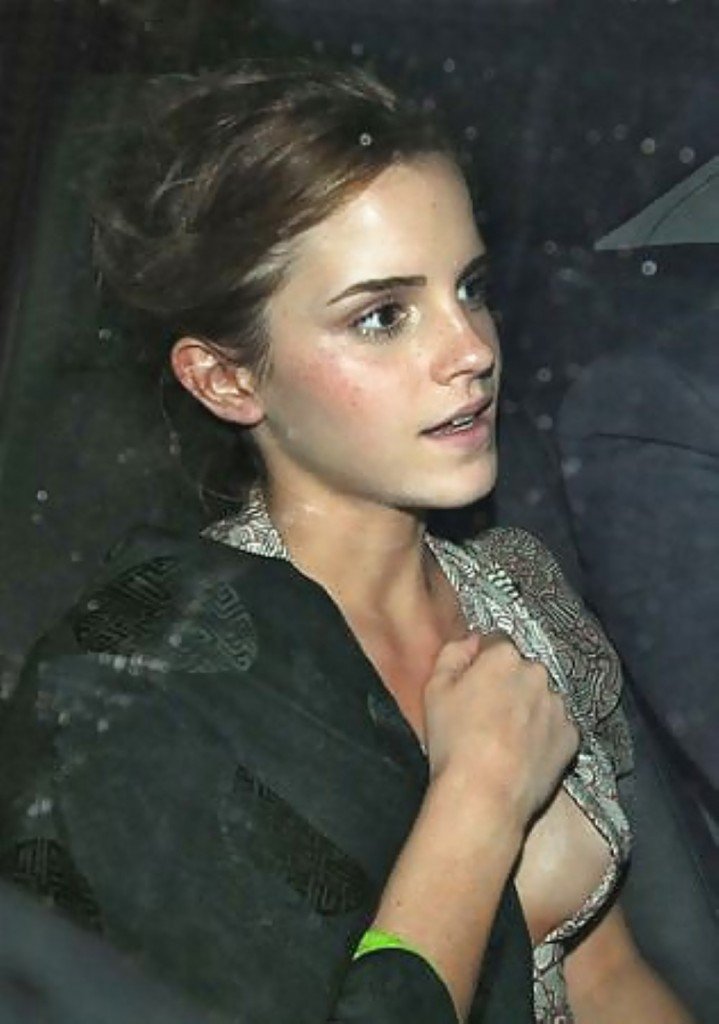 Emma Watson Ooops Collection (18 Photos)