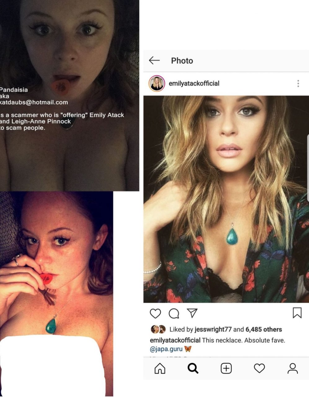 Emily Atack Nude Leaked Fappening (5 Photos)