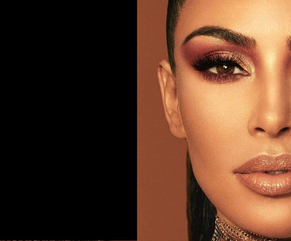Vitiligo Brown Queen &amp; Kim Kardashian Sexy (10 Photos)