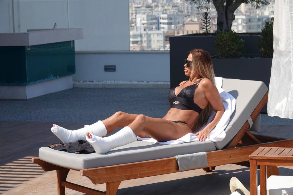 Katie Price Sits Poolside with Both Legs in Casts After Her Freak Accident in Turkey (13 Photos)