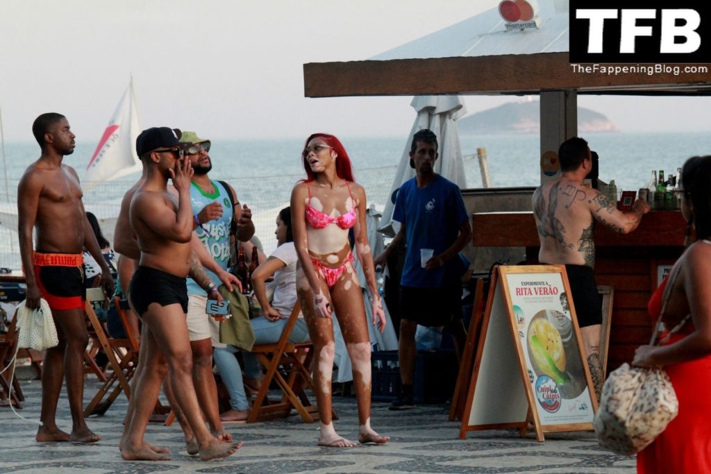 Winnie Harlow Shows Off Her Sexy Bikini Body at Ipanema Beach (128 Photos)