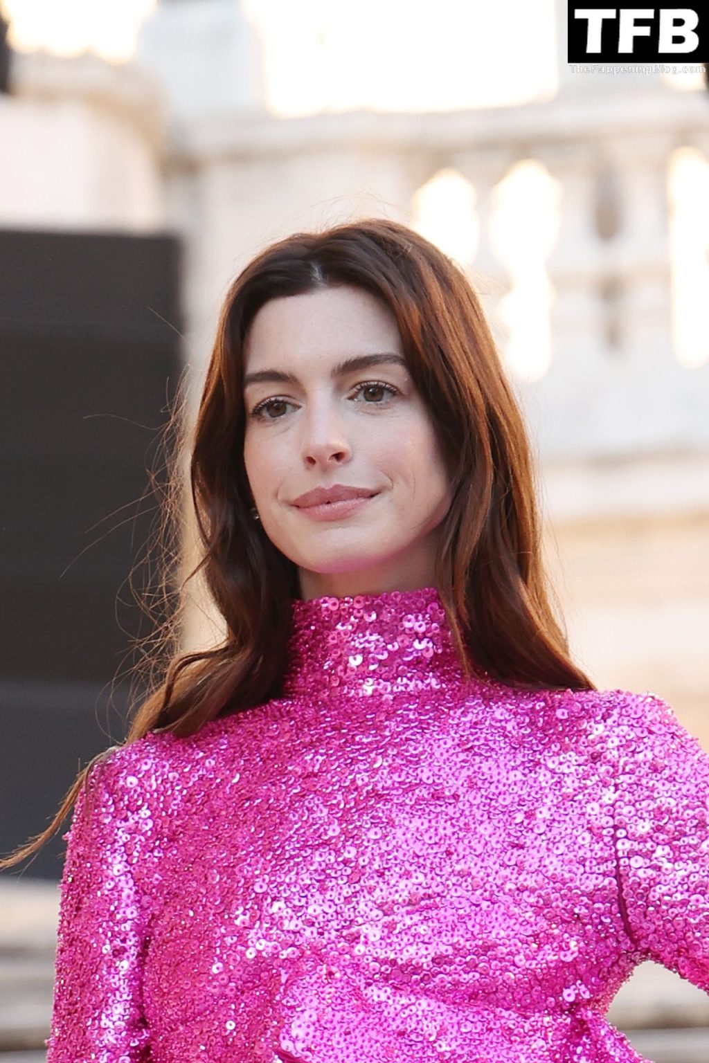 Anne Hathaway Flaunts Her Slender Legs in Rome (29 Photos)